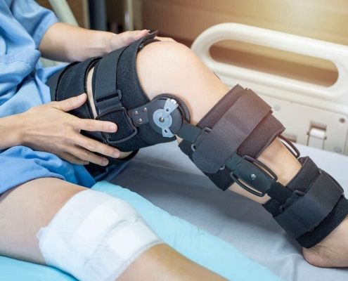 ACL Injuries